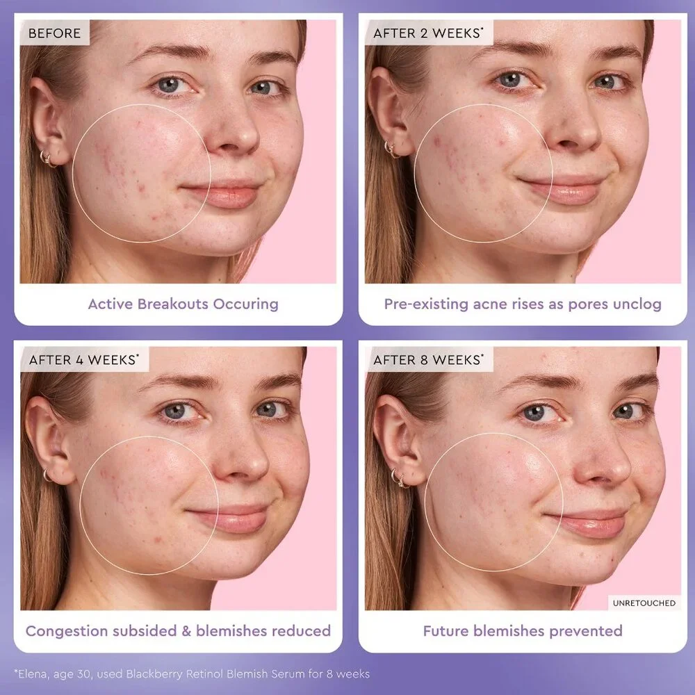 GLOW RECIPE BLACKBERRY RETINOL BLEMISH SERUM